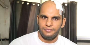 कोलकाता के पास ऑटोरिक्शा चालक से झगड़े के बाद सीमाशुल्क अधिकारी पर ‘हमला’, चार लोग गिरफ्तार