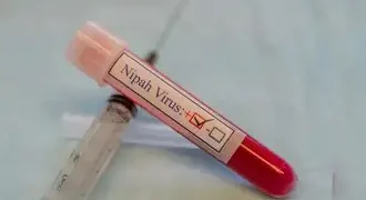 पश्चिम बंगाल सरकार ने निपाह वायरस संक्रमण के संदिग्ध और पुष्टि हो चुके मामलों के उपचार के लिए जारी किए दिशानिर्देश
