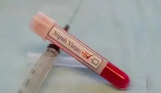 पश्चिम बंगाल सरकार ने निपाह वायरस संक्रमण के संदिग्ध और पुष्टि हो चुके मामलों के उपचार के लिए जारी किए दिशानिर्देश